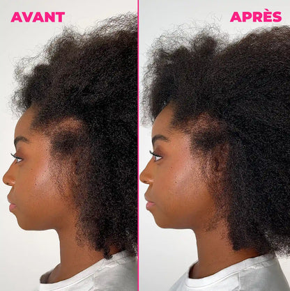 Kurl Hero - Sérum anti-chute, croissance et densifiant